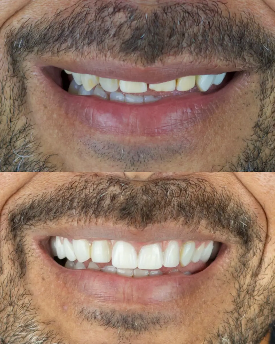 Antes e depois de tratamento odontológico